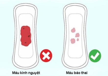 Dấu Hiệu Rụng Trứng Gặp Tinh Trùng Chứng Tỏ Bạn Đã Thụ Thai Thành Công
